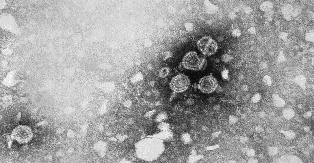Hepatitis deaths are rising despite vaccines and new treatments